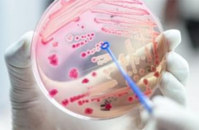 সেপসিস: রক্ত দূষণে কেন বিশ্বের পাঁচ জনের মধ্যে একজন মারা যাচ্ছে?