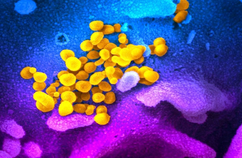 কোভিড-১৯ এর আসল ছবি প্রকাশ, ইউরোপে প্রথম মৃত্যু