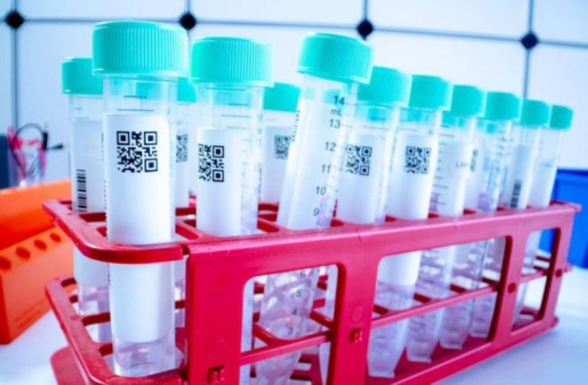 করোনাভাইরাস: শনাক্তকরণ পরীক্ষা পদ্ধতি কি ত্রুটিপূর্ণ?