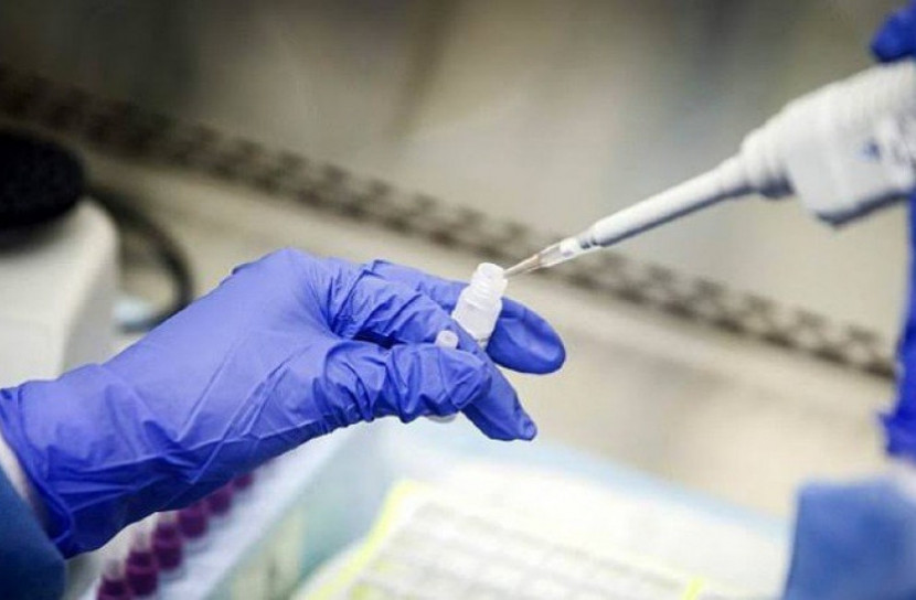 করোনা পরীক্ষার কিট উদ্ভাবন গণস্বাস্থ্য কেন্দ্রের