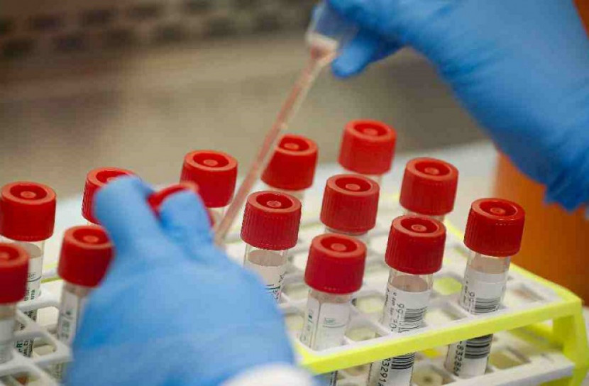 করোনা পরীক্ষায় আরো ১৭টি ল্যাব