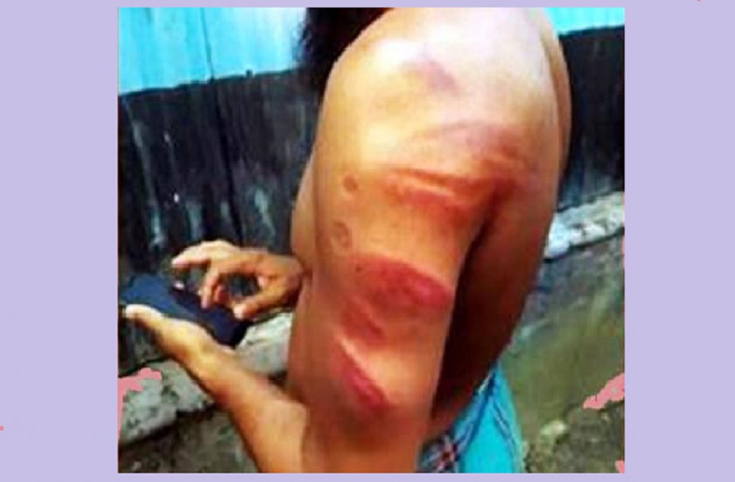 স্ত্রীর অভিযোগে শিক্ষককে পেটালেন চেয়ারম্যান