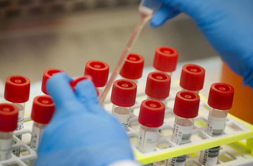 নতুন চার বেসরকারি হাসপাতালকে করোনা পরীক্ষার অনুমতি