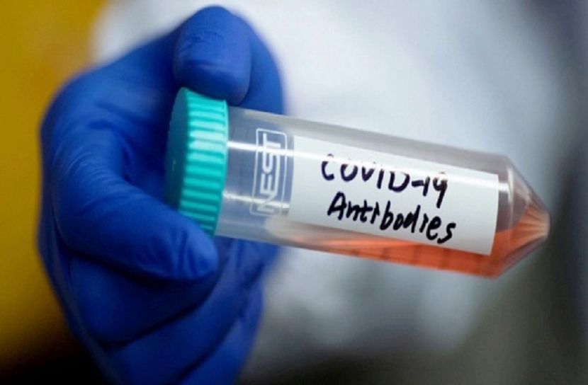 করোনার অ্যান্টিবডি তৈরিতে ইসরায়েলের সফলতা