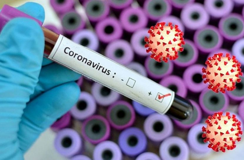 মুন্সীগঞ্জে চিকিৎসকসহ আরও ৩২ জন আক্রান্ত