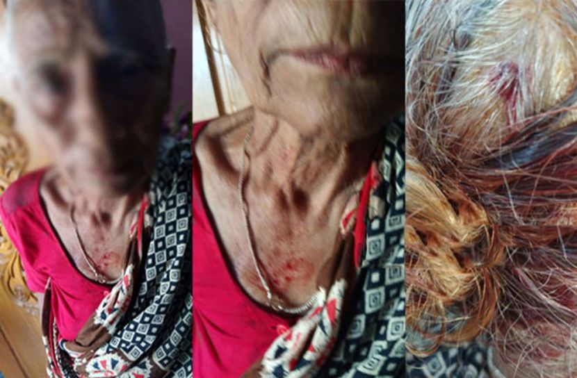 কোটি, টাকার, সম্পত্তি, লিখে, নিয়ে, মায়ের, মাথা, ফাটাল, সন্তান!,