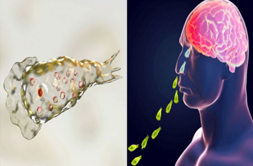 আমেরিকায় ভয়ঙ্কর ‘মগজ খেকো’ অ্যামিবার সন্ধান!