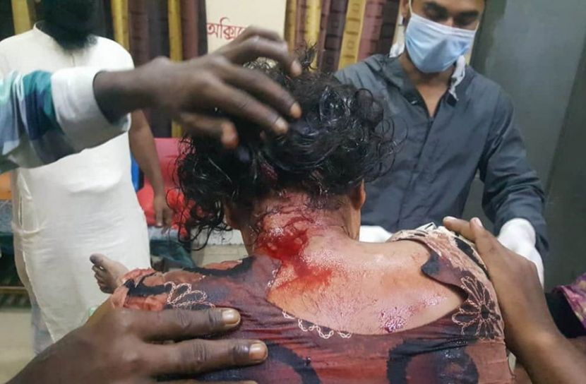 যৌতুকের দাবিতে স্ত্রীকে ব্লেড দিয়ে ক্ষত-বিক্ষত করলেন স্বামী