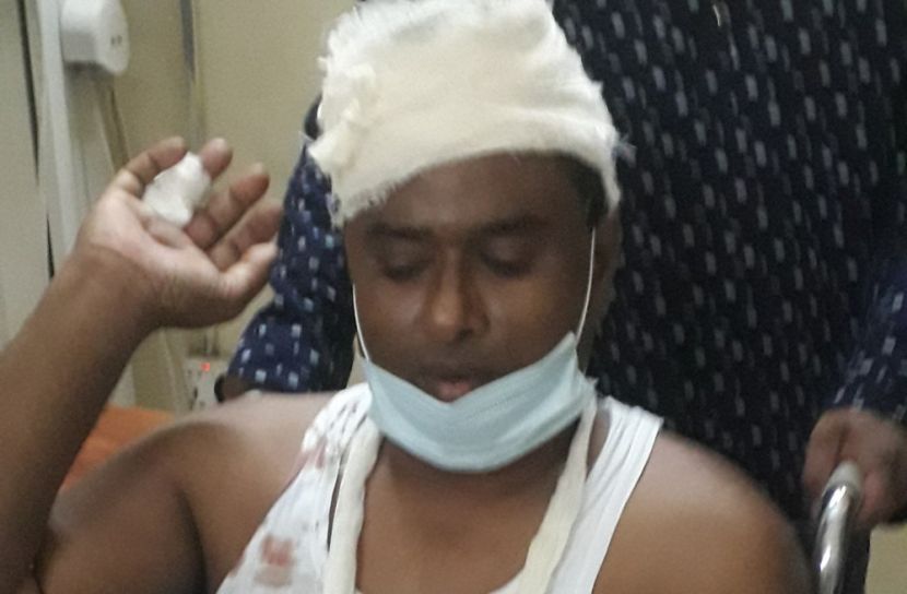 ফরিদপুরে দুর্বৃত্তদের ধারালো অস্ত্রের আঘাতে আওয়ামী লীগ নেতা আহত