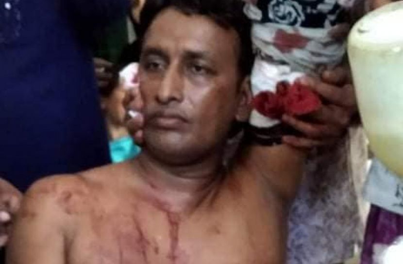 বোয়ালমারীতে সন্ত্রাসী হামলায় কৃষকলীগ নেতা আহত