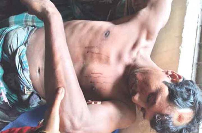 চরের জমি দখলের সংঘর্ষে আহত ১৩