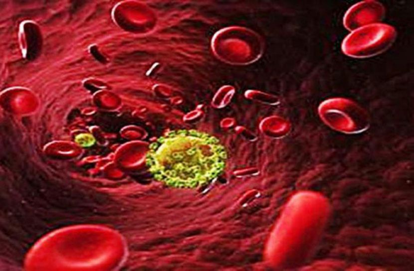 বিনা ওষুধে এইডস মুক্ত হলেন নারী!