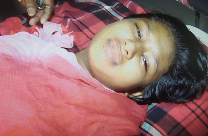 গুলিবিদ্ধ লামিয়া