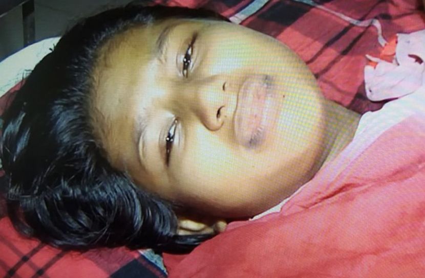 অস্ত্রোপচারে ঝুঁকিমুক্ত গুলিবিদ্ধ স্কুলছাত্রী লামিয়া 