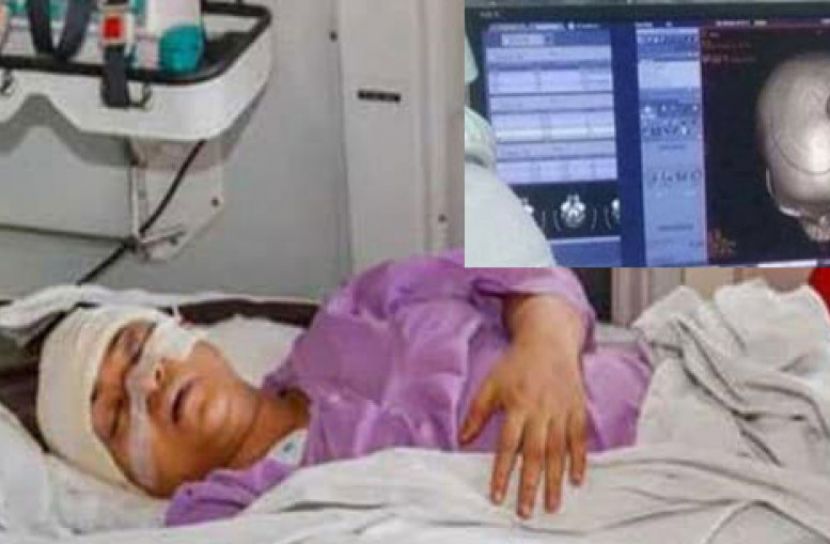 ‘ওয়াহিদা খানমের সিটি স্ক্যান ফলাফল ভালো, তবে শঙ্কামুক্ত নন’