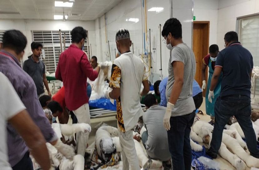 বার্ন ইউনিটের সবার শরীরের ৩০ শতাংশ পুড়েছে