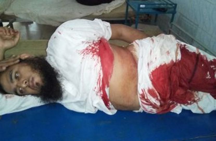 ভোলায় ছুরিকাঘাতে ব্যবসায়ী গুরুতর আহত