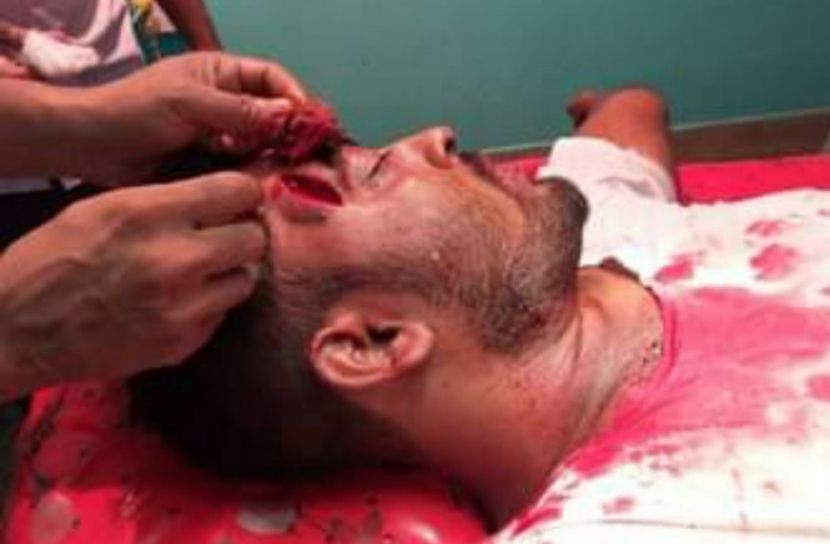 গুরুতর আহত মো. জনি মিয়া