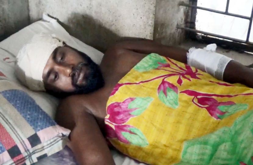 আহত মিলন মৃধা