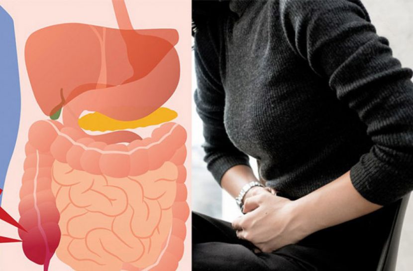 জেনে নিন বিপজ্জনক অ্যাপেনডিসাইটিসের লক্ষণগুলো