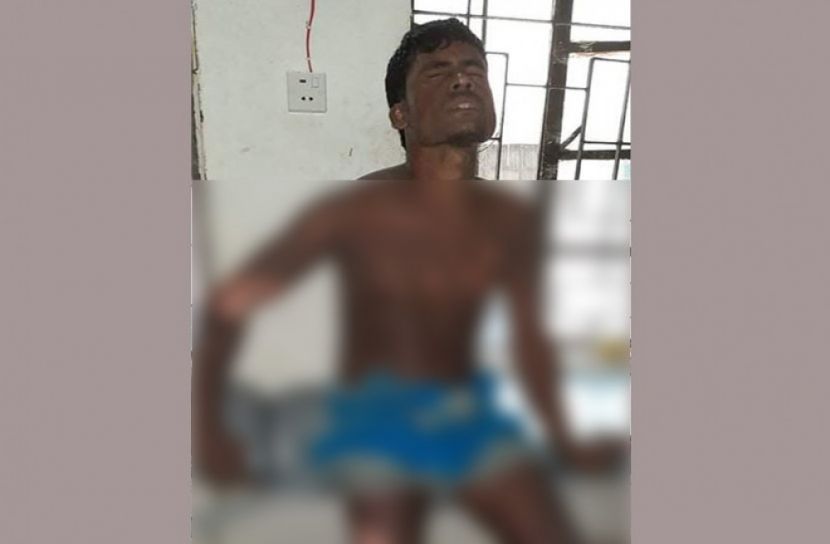 মনপুরায় ট্রলারে গ্যাস সিলিন্ডার বিষ্ফোরনে দুই জেলে দগ্ধ 