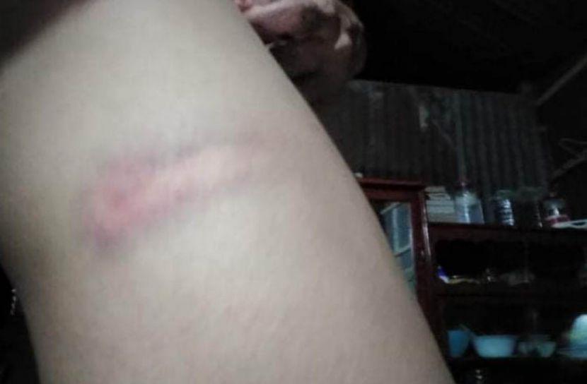 পাষন্ড স্বামীর নিষ্ঠুর নির্যাতনের শিকার স্কুল শিক্ষিকা