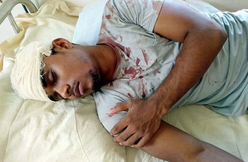 রাজাপুরে কলেজ ছাত্রের উপর দুর্বৃত্তের হামলা