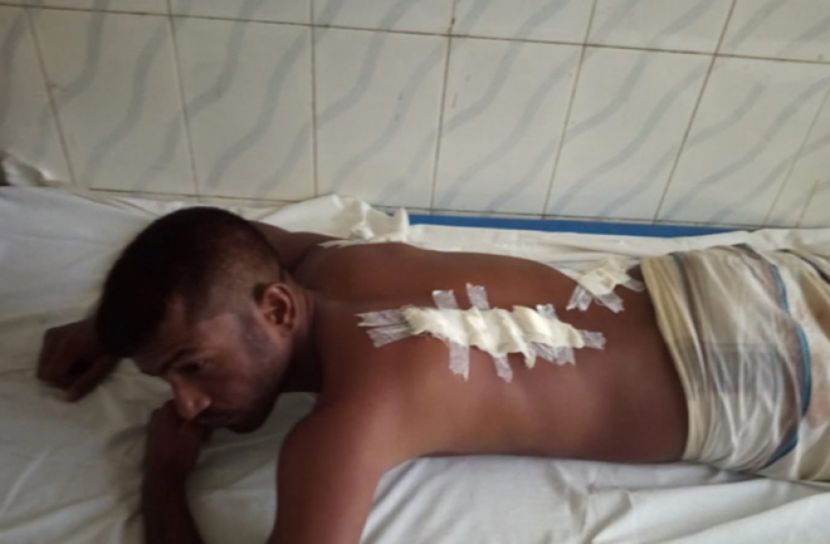 পাবনায় টেন্ডার নিয়ে সংঘর্ষ, আহত ৫