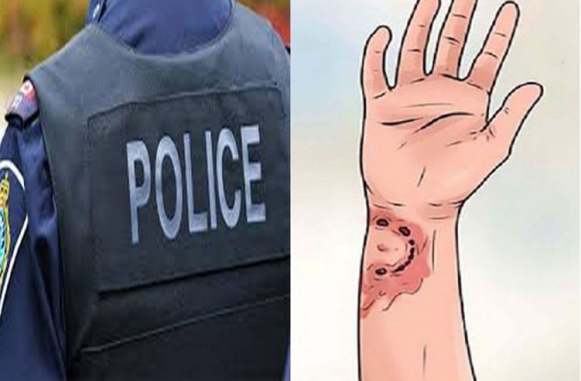 পুলিশকে কামড়ানো মাদক বিক্রেতা গ্রেপ্তার