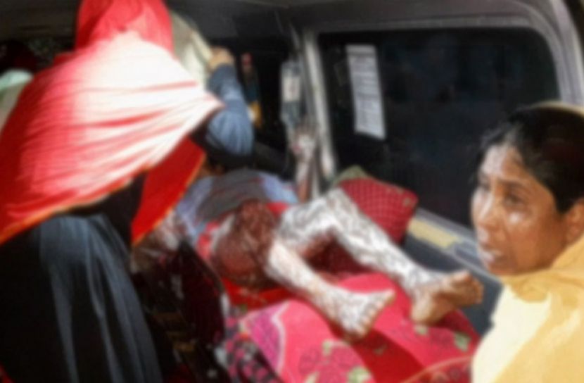 চুয়াডাঙ্গায় ফ্রান্স প্রেসিডেন্টের কুশপুতুল দাহের সময় তিনজন অগ্নিদগ্ধ