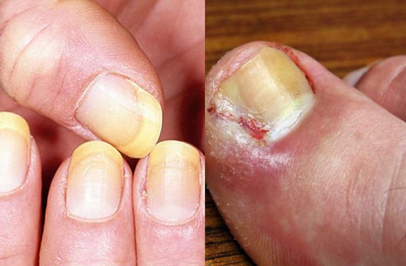 নখের যত্ন ও হোম প্রতিকার