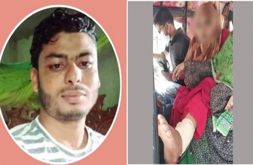 পরকীয়ার অভিযোগে স্ত্রীর পায়ের রগ কাটলেন স্বামী, অতঃপর