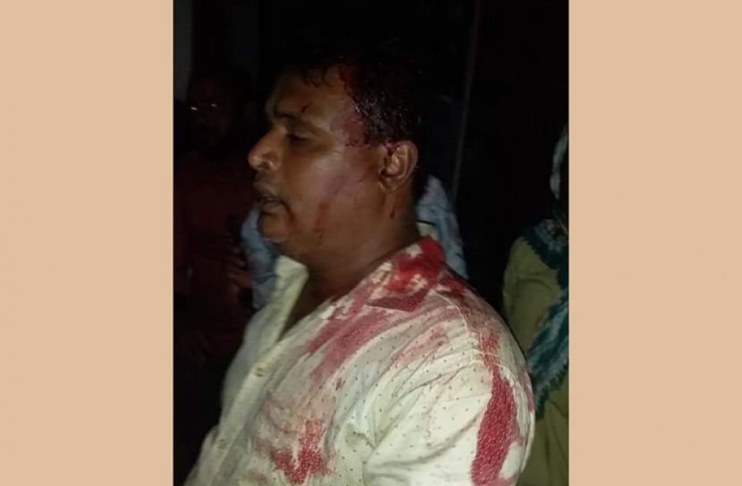 শ্যামনগরে বোরখা পরে ইউপি চেয়ারম্যানকে হত্যার চেষ্টা