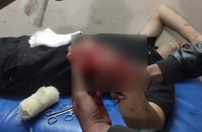 চাঁপাইনবাবগঞ্জে ছাত্রলীগ নেতাকে কোপালো দুর্বৃত্তরা