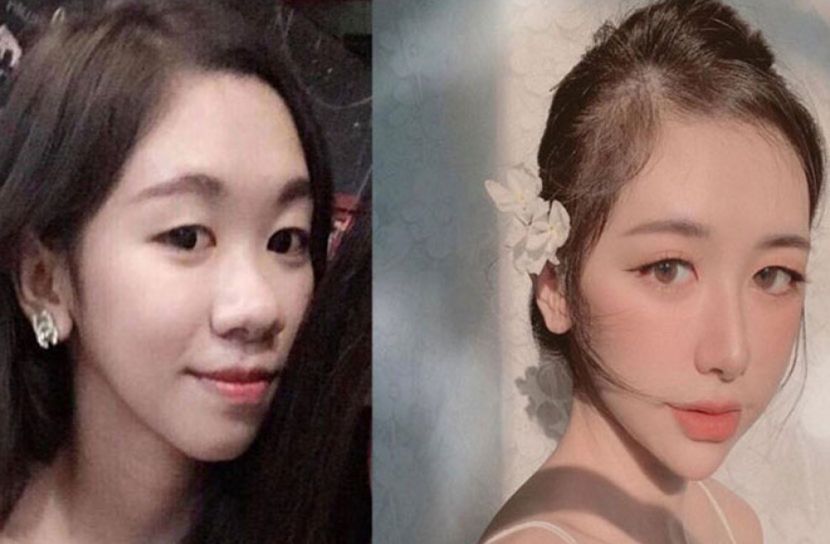 চেহারার দোষে বিচ্ছেদ, অতঃপর তরুণীর চমক