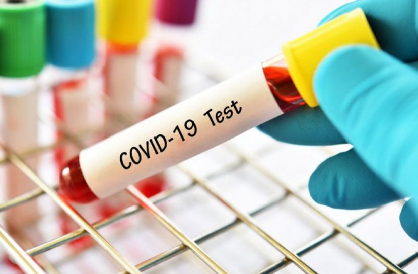 এবার ঘরে বসেই ৩০ মিনিটে করোনা টেস্ট