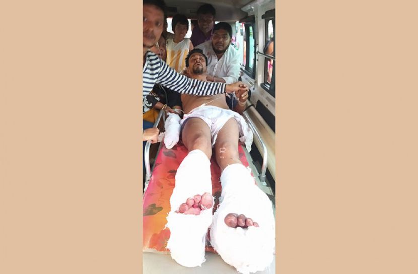 বরগুনায় ইউপি চেয়ারম্যানকে কুপিয়ে জখম