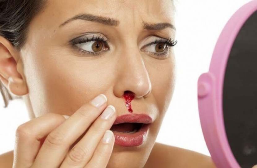 নাকের রক্তপাত বন্ধে ঘরোয়া উপায়