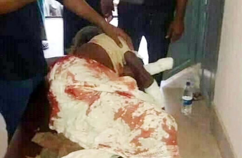 ফটিকছড়িতে যুবকের এলোপাতাড়ি কোপে ১১ জন জখম