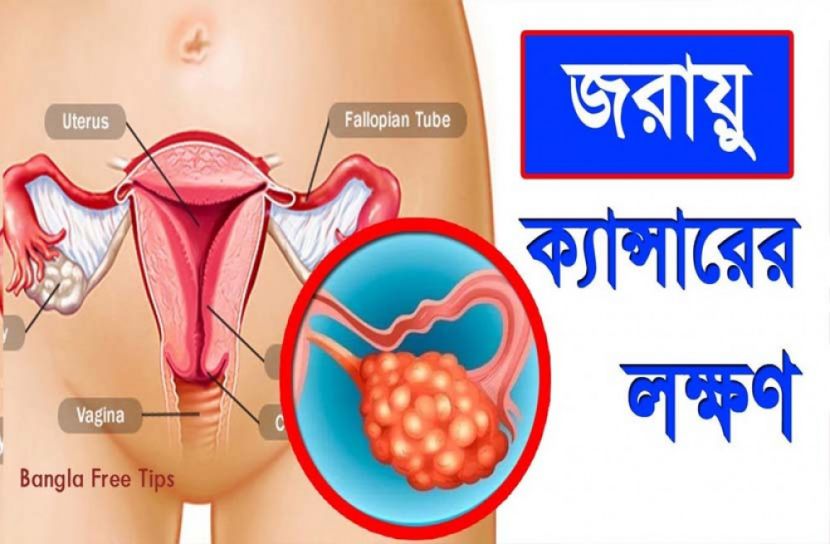 জরায়ু ক্যান্সার প্রতিরোধে পেপ স্মিয়ার টেস্ট কতদিন পর করাবেন?