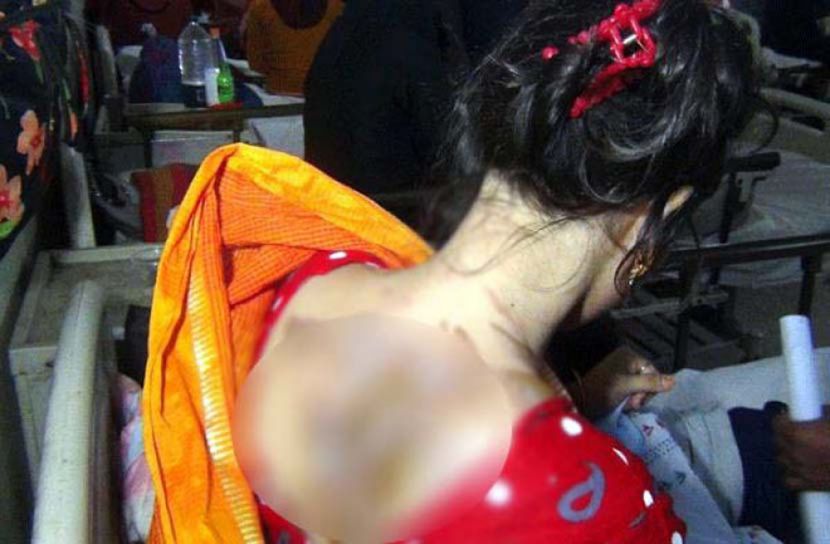 গরম পানি দিয়ে স্ত্রীর শরীর ঝলসে দিলো স্বামী