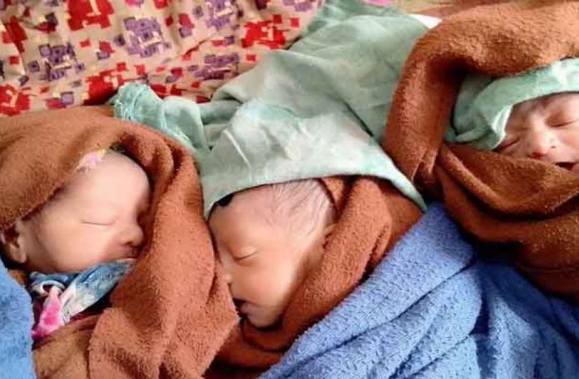 শেরপুরে ৩ জমজ সন্তানের জন্ম দিলেন প্রসূতি মা