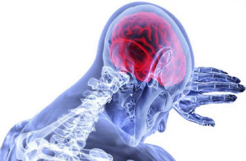 ব্রেইন স্ট্রোকের লক্ষণ সমুহ জেনে রাখা ভাল