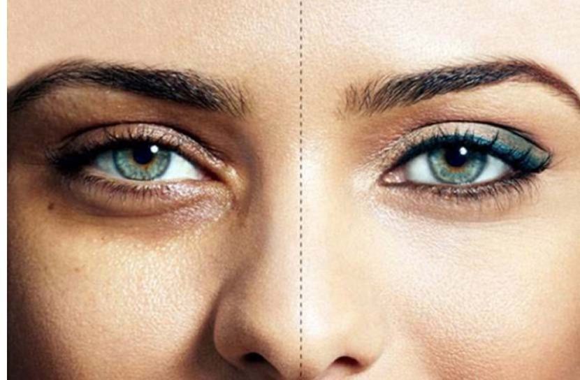 শীতকালে চোখের সমস্যার ১০ ঘরোয়া সমাধান