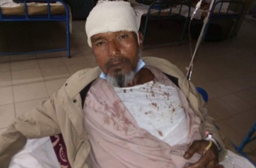 ভাঙা কাঁচ দিয়ে বৃদ্ধের মাথা ফাটালো বখাটে