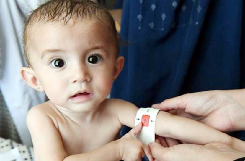 করোনায় অপুষ্টির ঝুঁকিতে শিশুরা