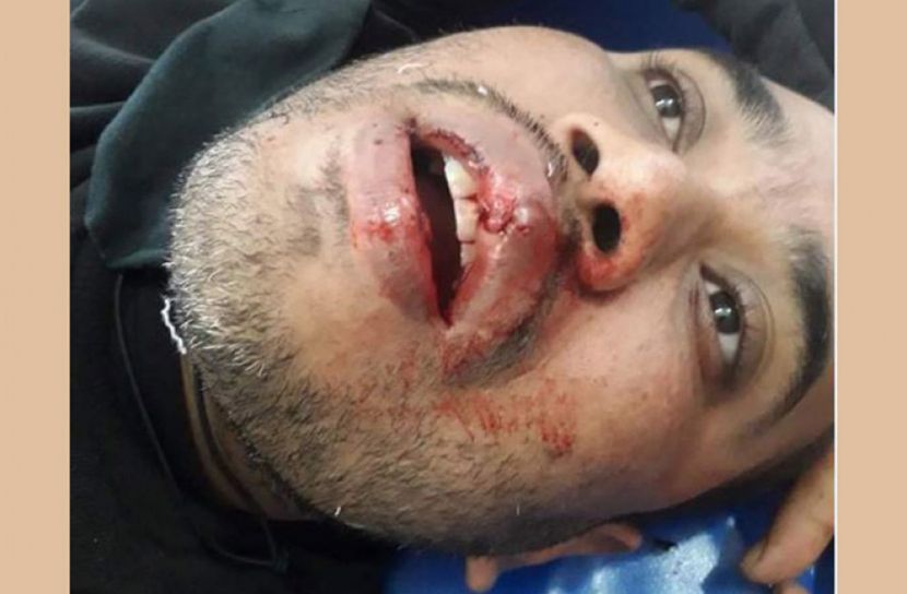 টঙ্গিবাড়ীতে ২ ভাইকে পিটিয়ে কুপিয়ে জখম