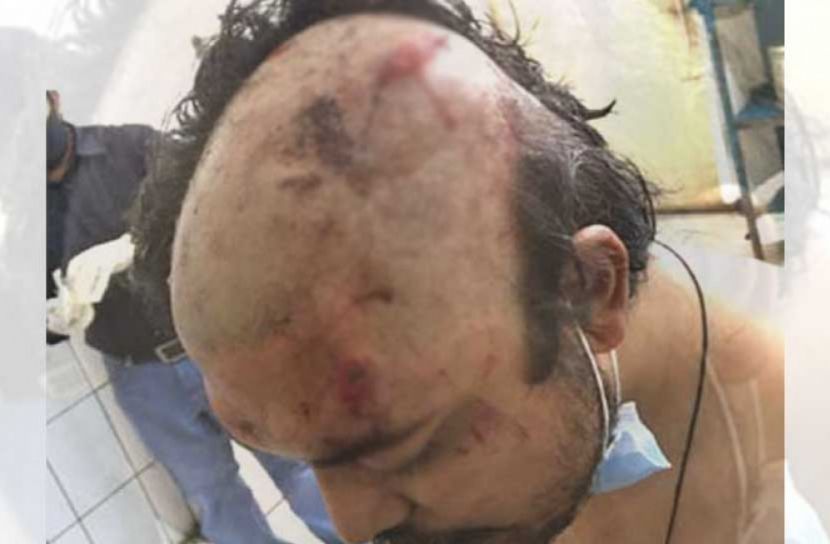 চট্টগ্রামে আ. লীগ-বিএনপির সংঘর্ষে আহত ৩