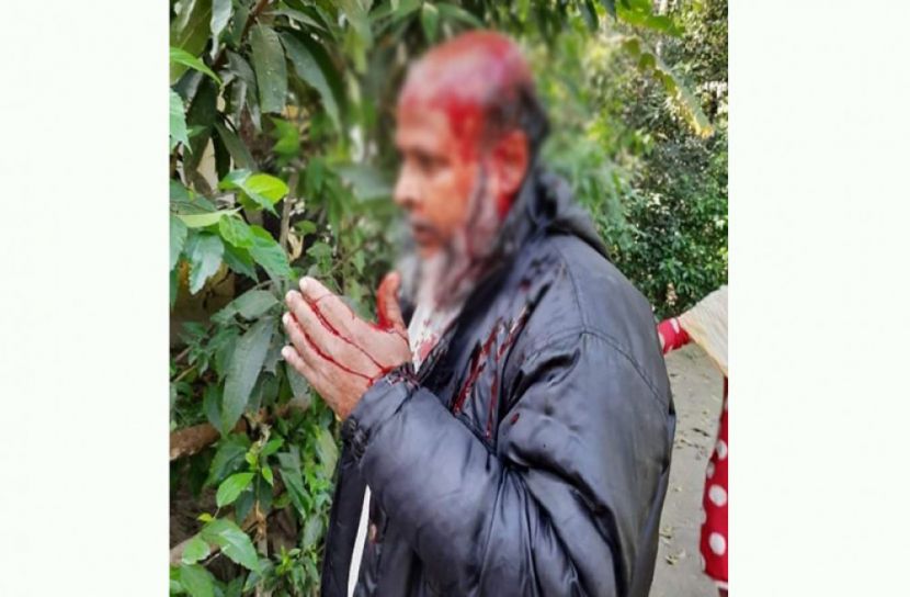মেয়েকে উত্ত্যক্তের প্রতিবাদ করায় বাবাকে পিটিয়ে জখম 