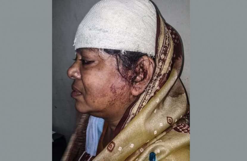 মেয়েকে শ্লীলতাহানী থেকে বাঁচাতে গিয়ে মা-ছেলে আহত